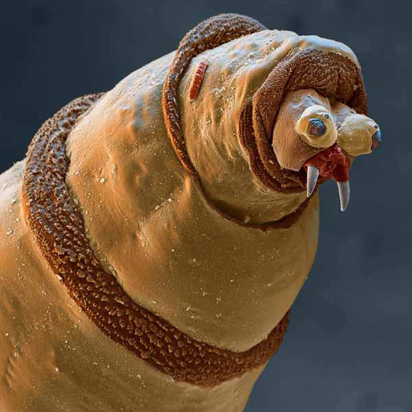 Coloured Scanning Electron Micrograph Of Tiny Horrors...***EXCLUSIVE, SPECIAL FEES*** UNSPECIFIED - UNDATED: Coloured scanning electron micrograph (SEM) of the head of a Maggot (larva) of a Bluebottle fly (Protophormia sp.). The maggots of this fly are used medicinally to clean wounds. Its mouthparts are seen at centre right (grey). The maggots are sterilised and placed in the wound, where they feed on dead tissue and leave healthy tissue untouched. Their saliva contains anti- bacterial chemicals which maintain sterility in the area. Maggots are used on ulcers and deep wounds away from organs or body cavities, most often being used to treat diabetic ulcers on the feet. Magnification: x45 at 6x7cm size. x70 at 4x5". Stunningly detailed pictures magnified by over a MILLION times reveal a true house of tiny horrors - in your home. Shown here through an ultra-powerful Scanning Electron Microscope (SEM) are the tiny beasts living secret lives undetected - right under your nose. One incredible image shows a maggo