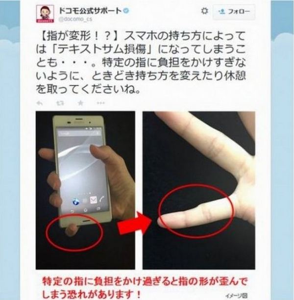 this-is-what-happens-to-your-pinky-if-you-are-holding-your-smartphone-like-this-1