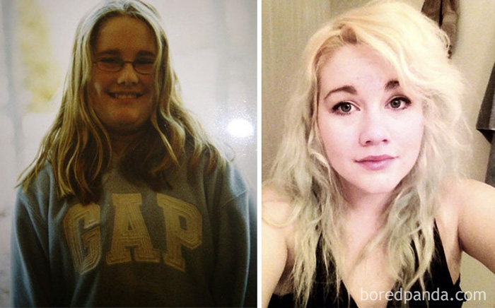 before-after-ugly-duckling-beauty-transformation-01a