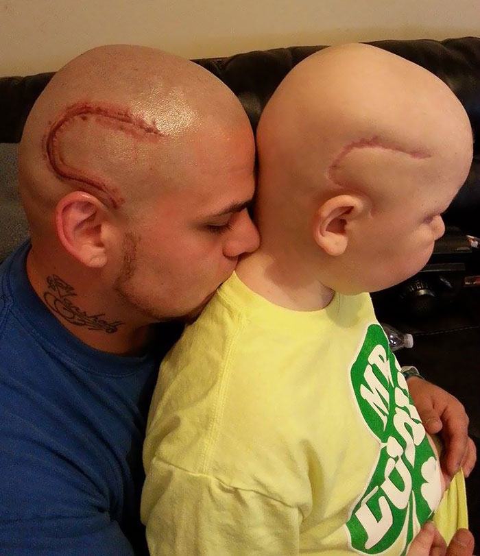 cancer-tattoo-scar-son-father-josh-mash-marshall-5