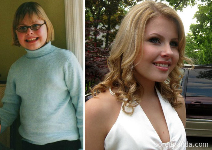 before-after-ugly-duckling-beauty-transformation-09