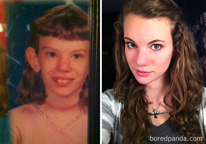 before-after-ugly-duckling-beauty-transformation-6
