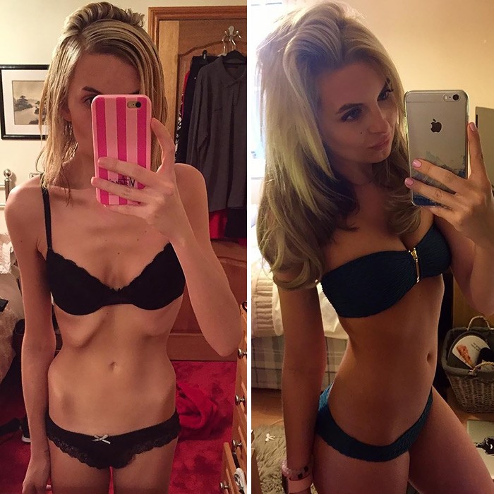 anorexia-recovery-before-after-136-58f7510098ddf__700