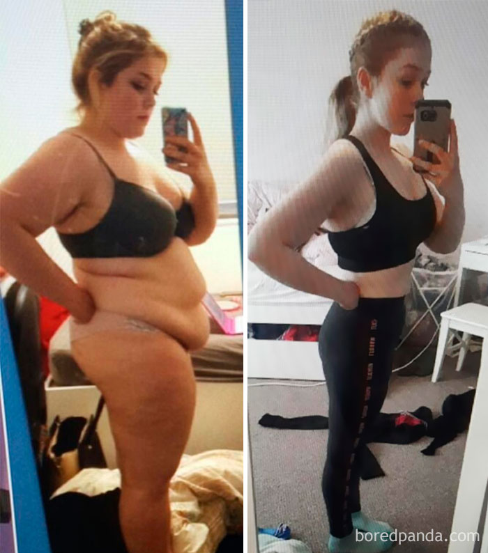 before-after-weight-loss-success-stories-37-59d3819b9304e__700