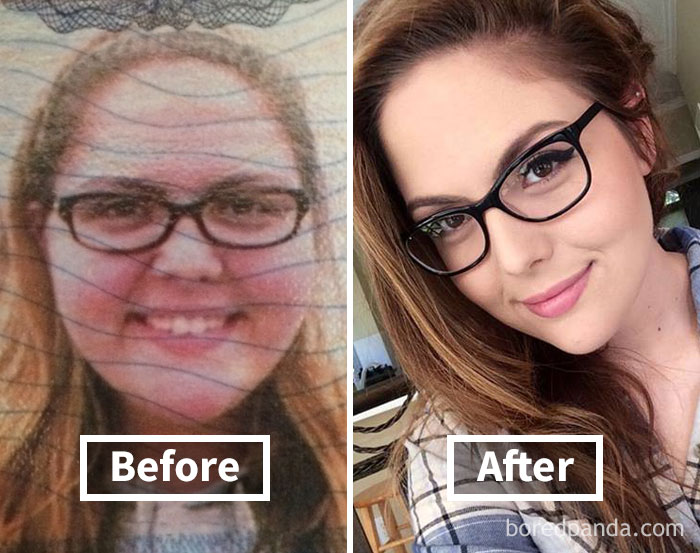 before-after-weight-loss-face-transformation-129-5a27b3b256d14__700