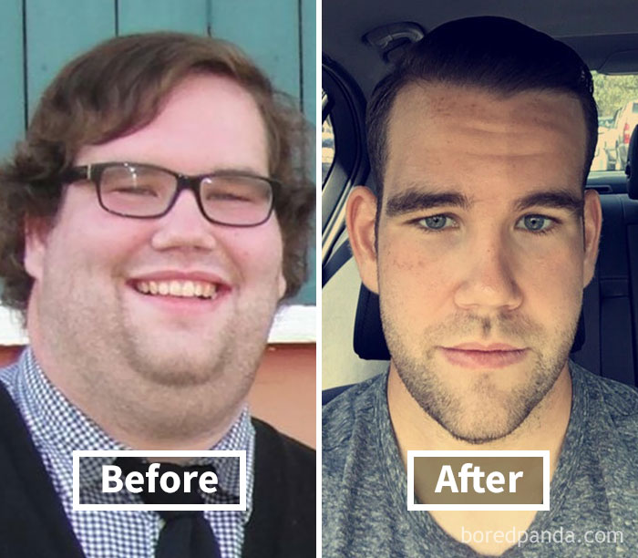 before-after-weight-loss-face-transformation-146-5a2a65d7740af__700