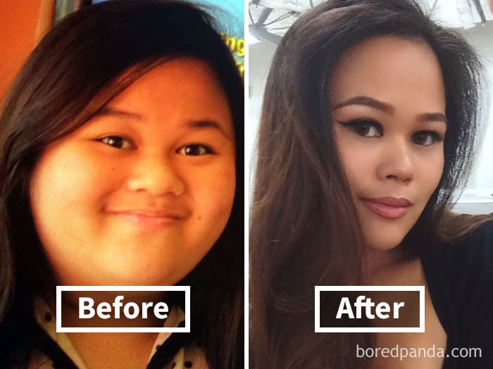 before-after-weight-loss-face-transformation-152-5a2fdd6c7625e__700