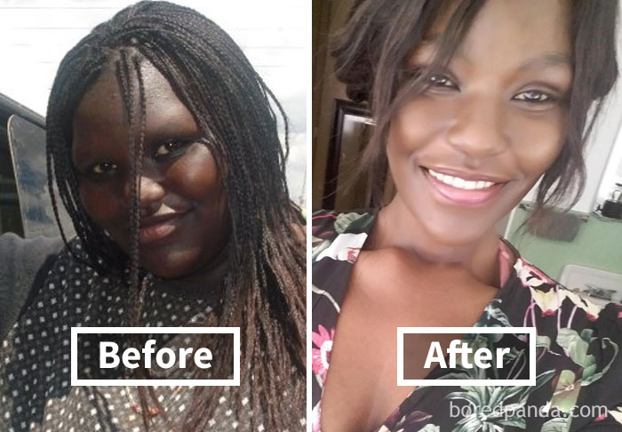before-after-weight-loss-face-transformation-202-5a2e7858092f7__700