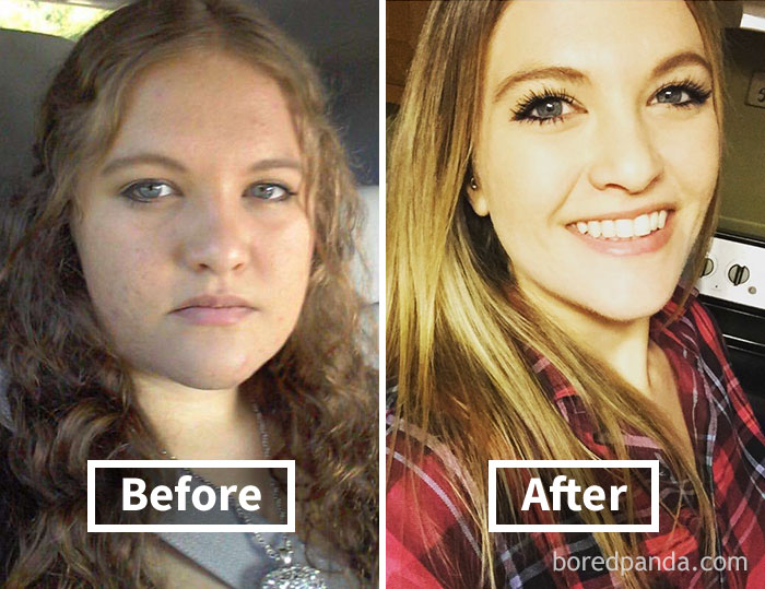 before-after-weight-loss-face-transformation-251-5a2149712ba11__700