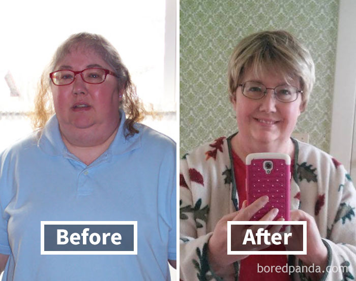 before-after-weight-loss-face-transformation-32-5a1d0f397384a__700