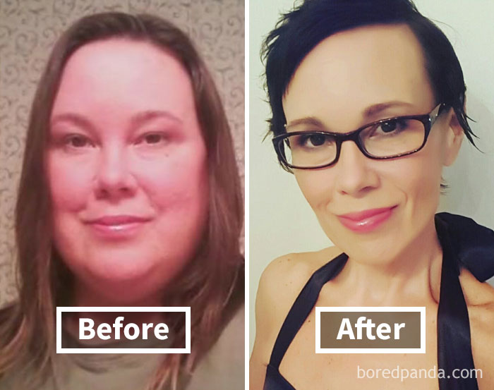 before-after-weight-loss-face-transformation-41-5a1d2b48bba59__700