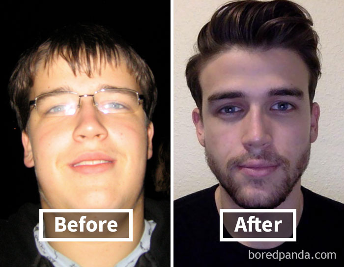 before-after-weight-loss-face-transformation-48-5a1d41971c377__700