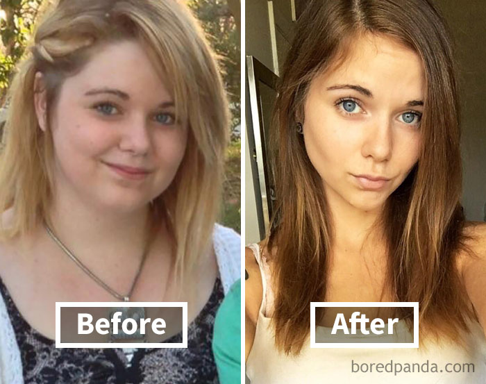 before-after-weight-loss-face-transformation-57-5a1ed678a35ee__700